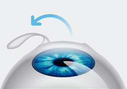 Сколько стоит операция на глаза близорукость в вологде